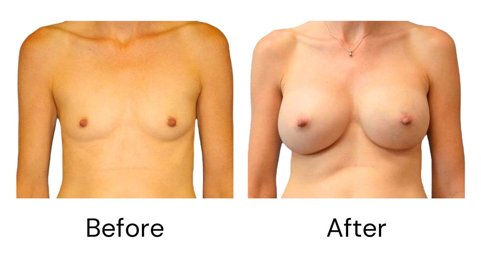 Client results