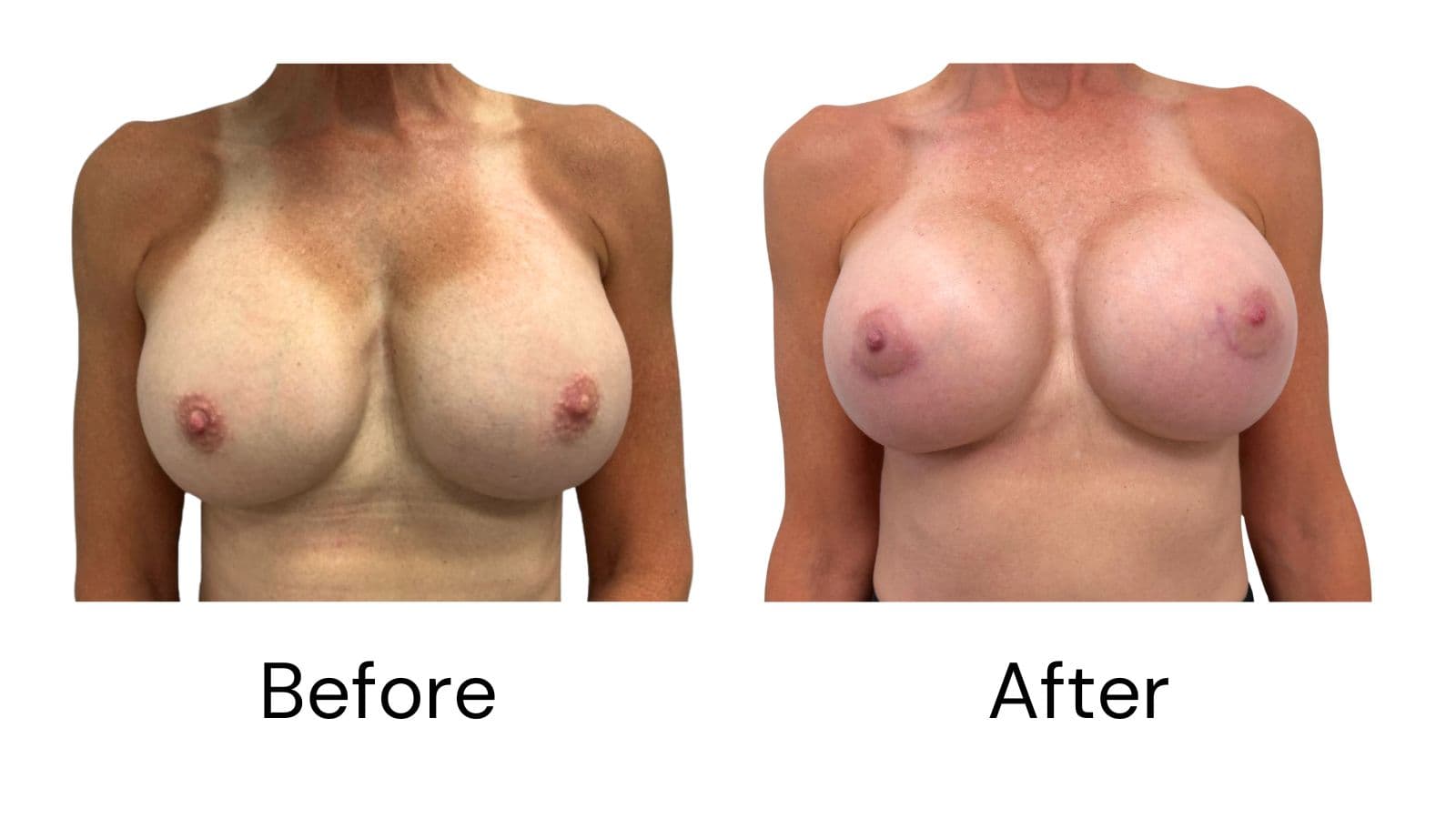 Client results