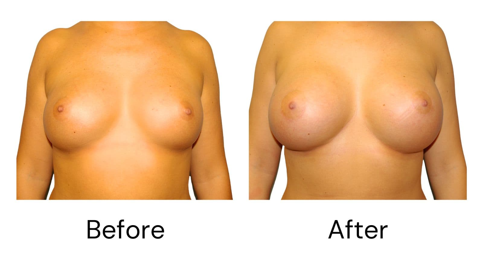 Client results