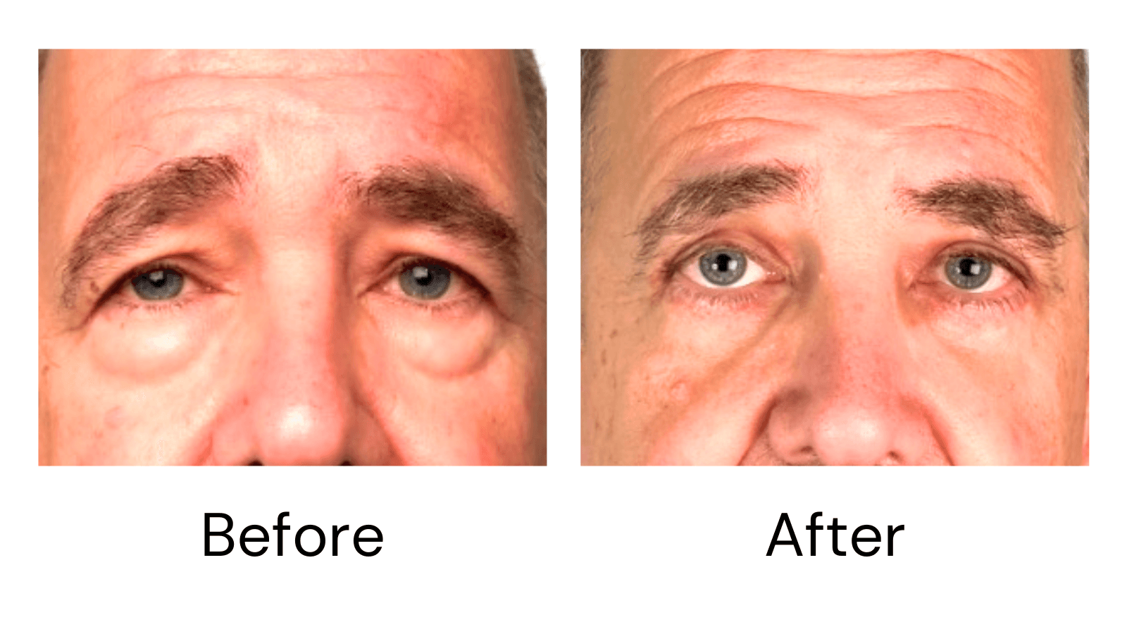 Client result