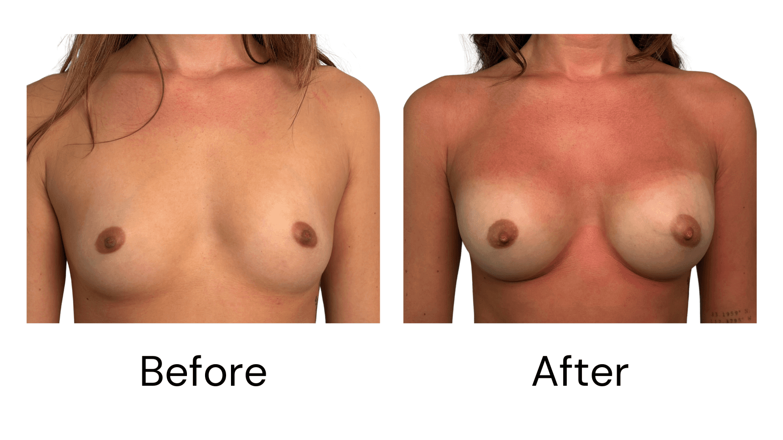 Before & After