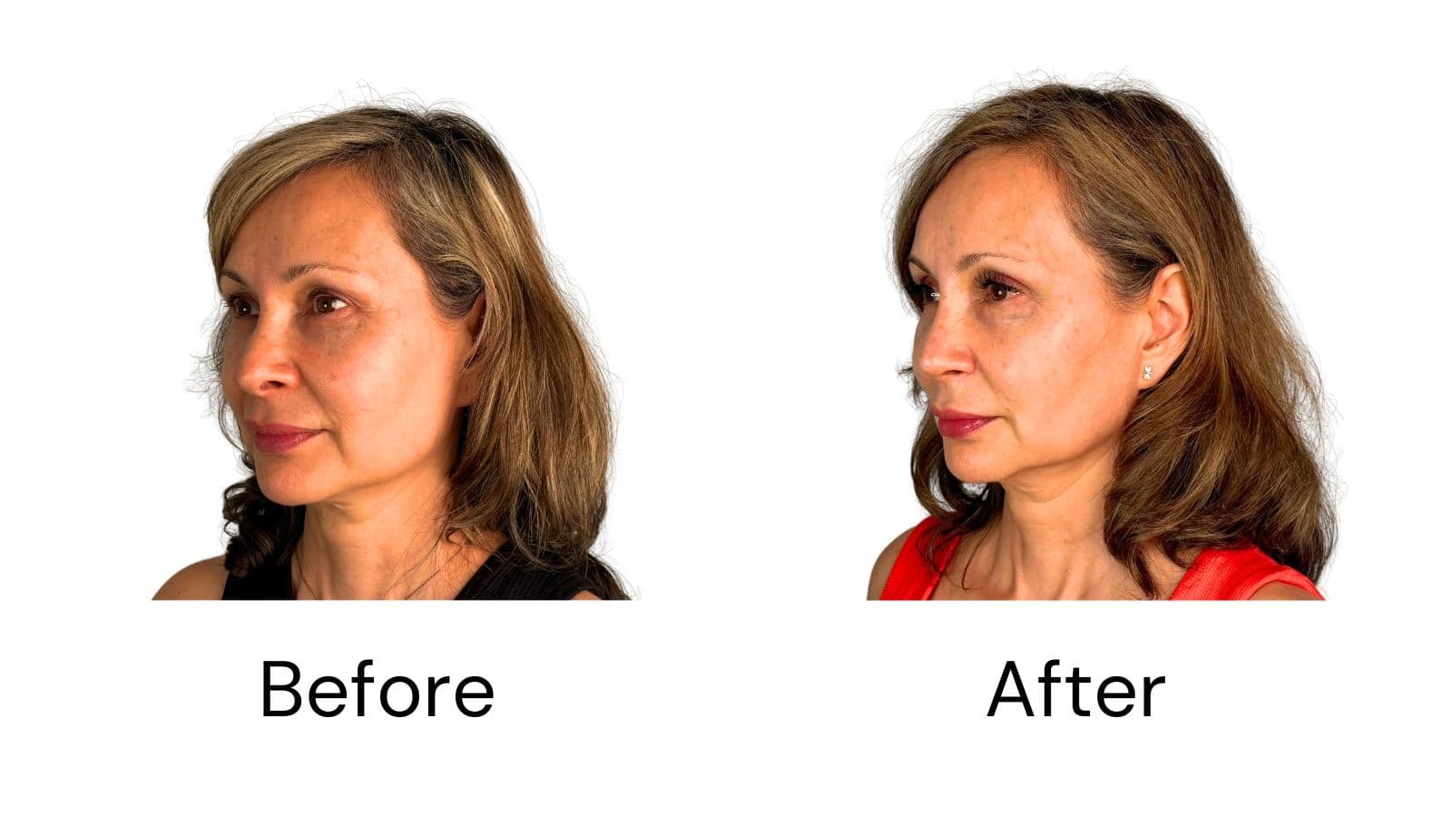 Client Results