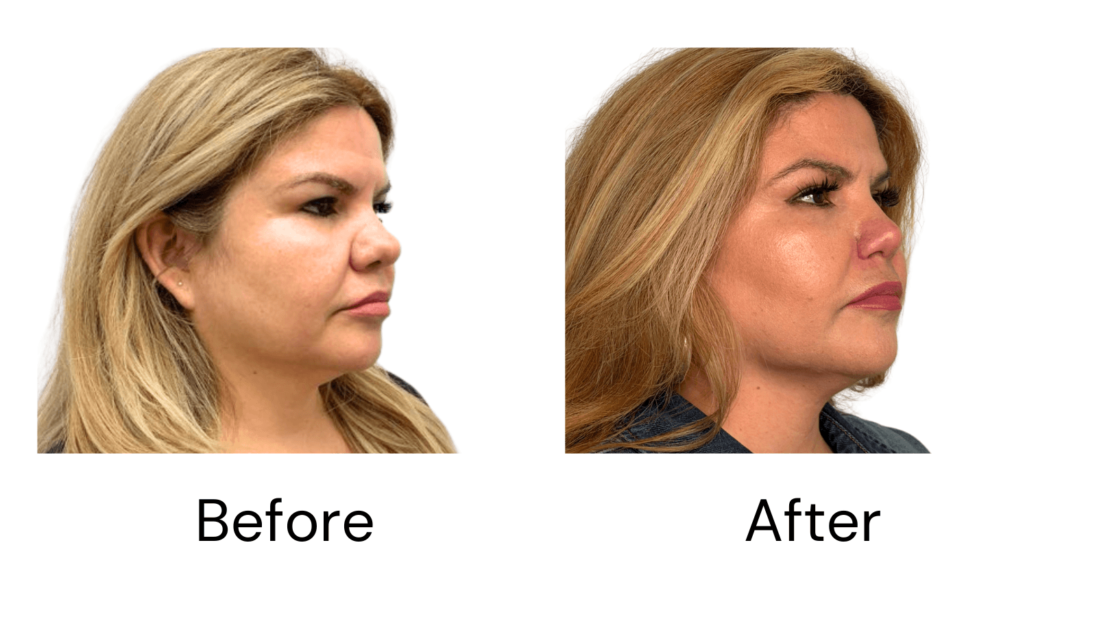 Client Results