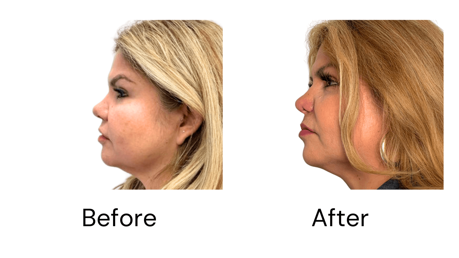 Client Results