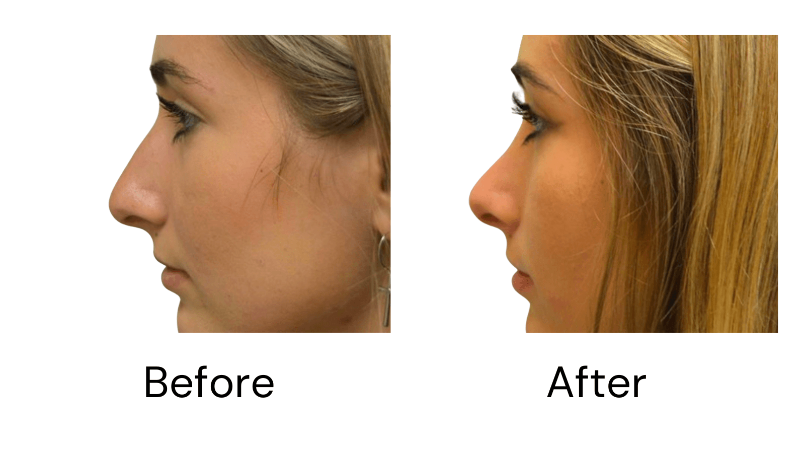Client Results