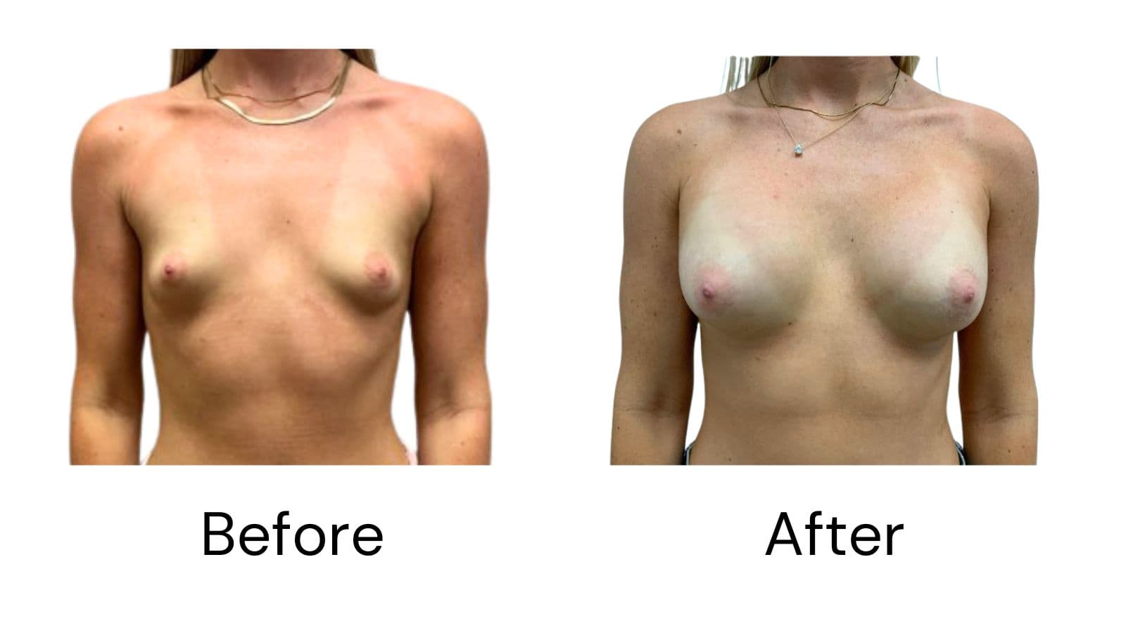 Before & After