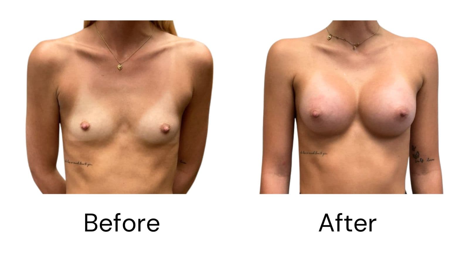 Before & After