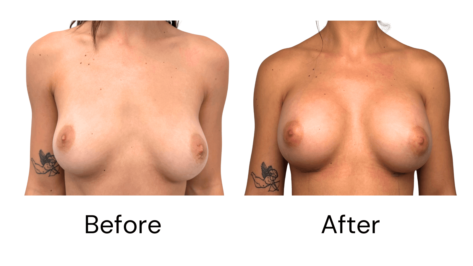 Before & After