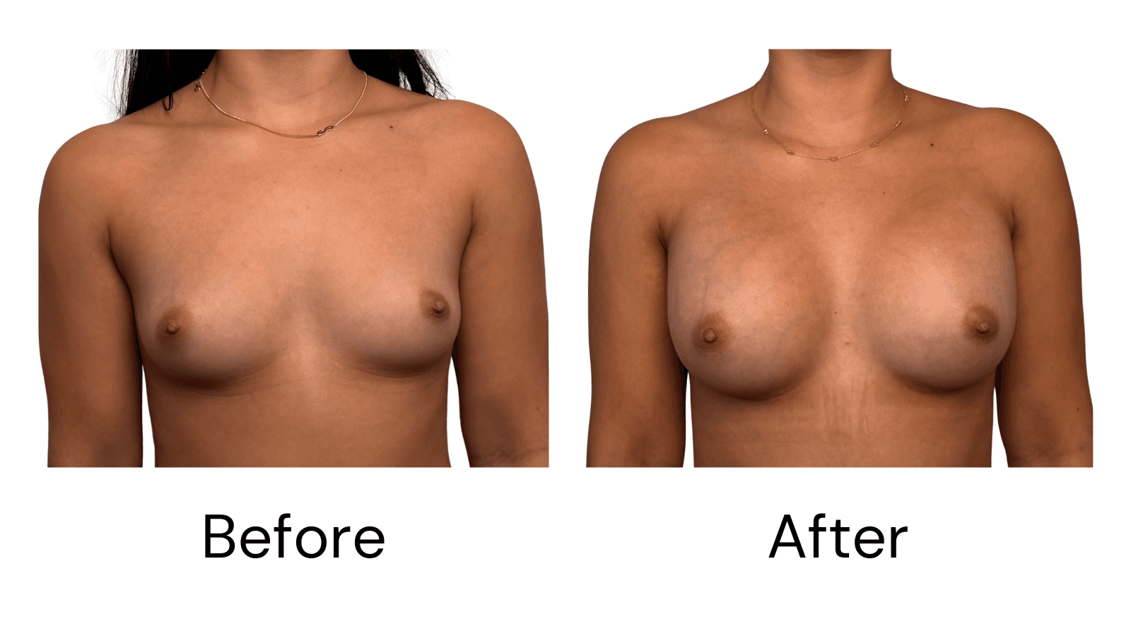 Before & After