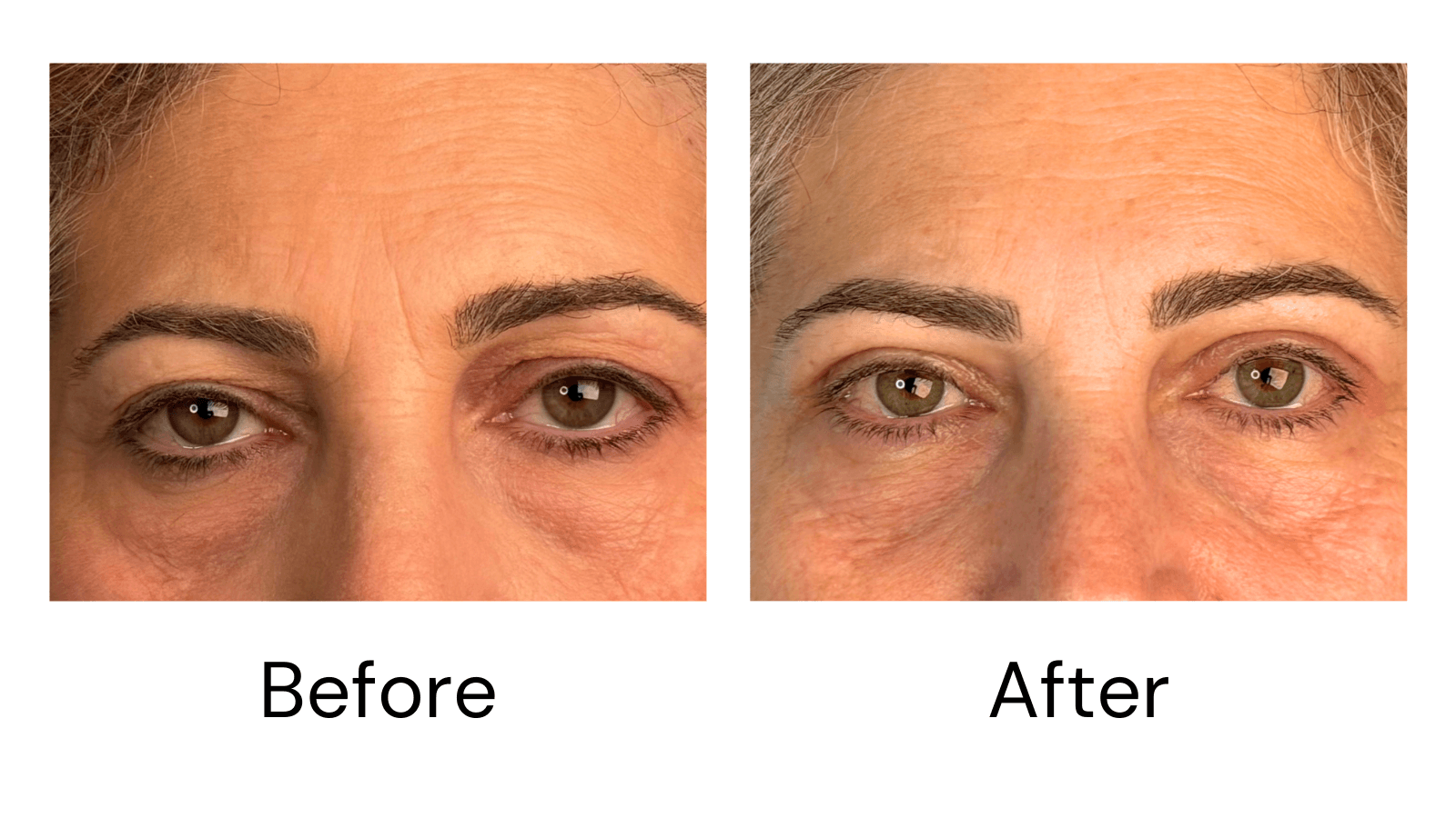 Client result