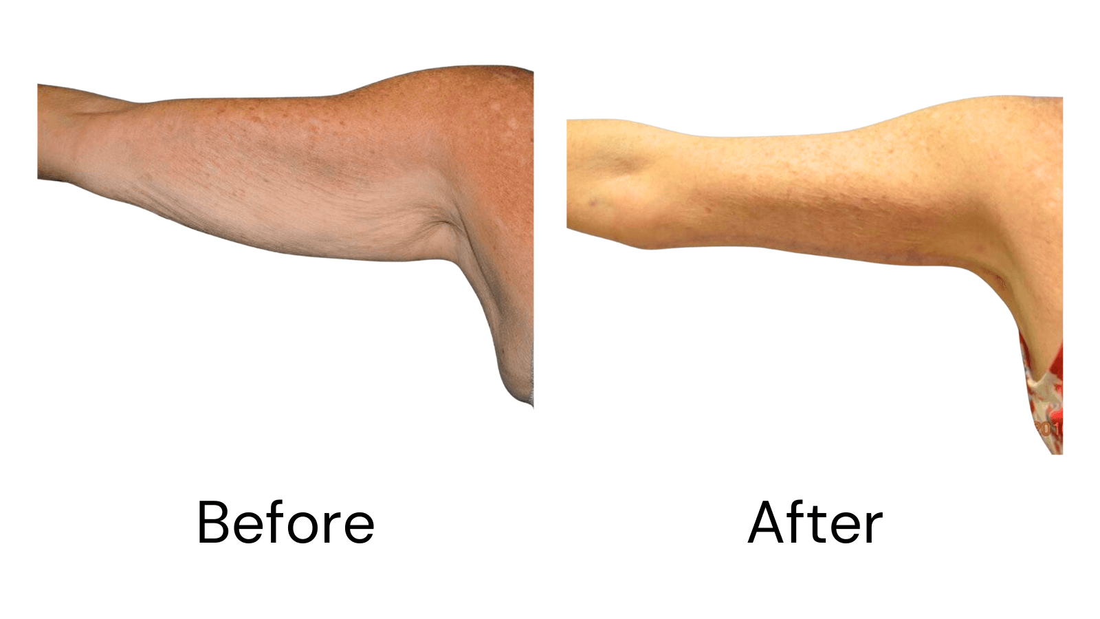 Client Results