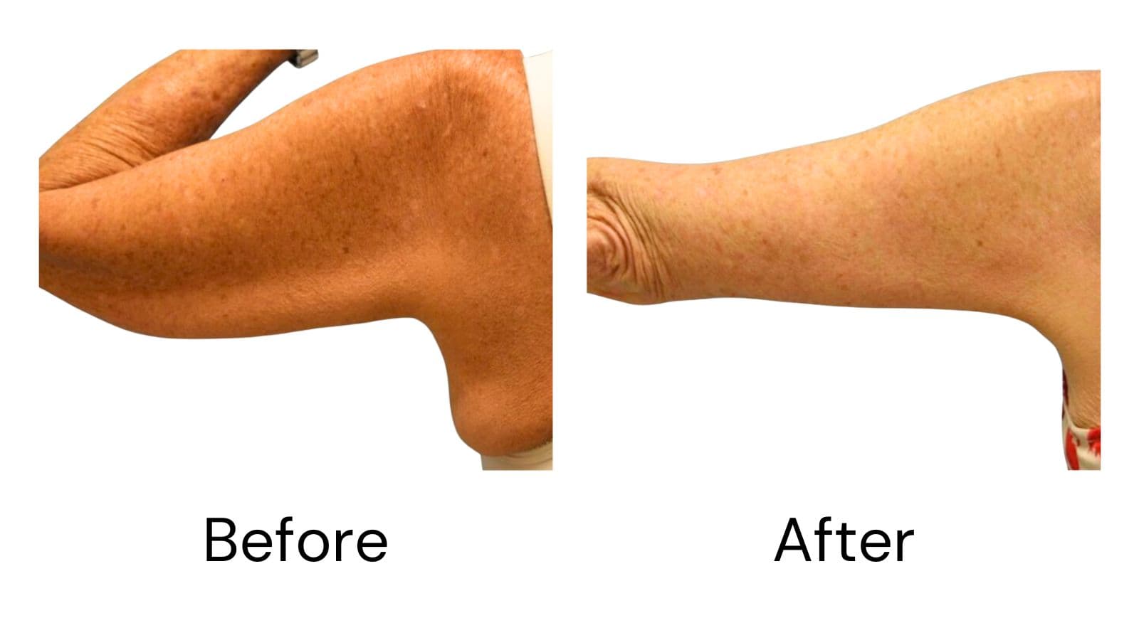 Client Results