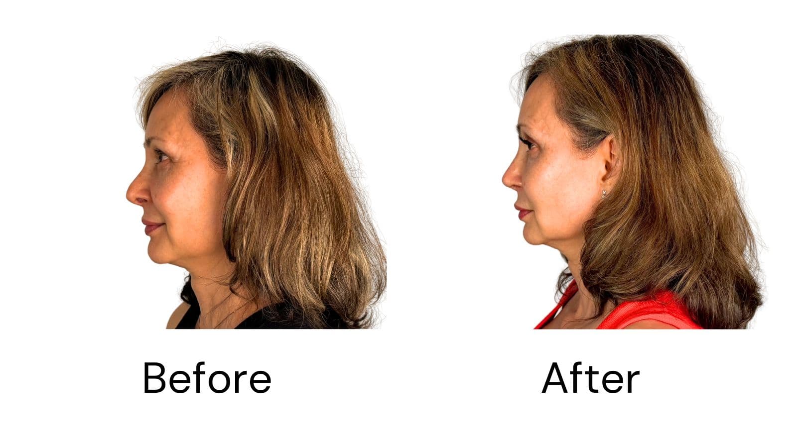 Client Results