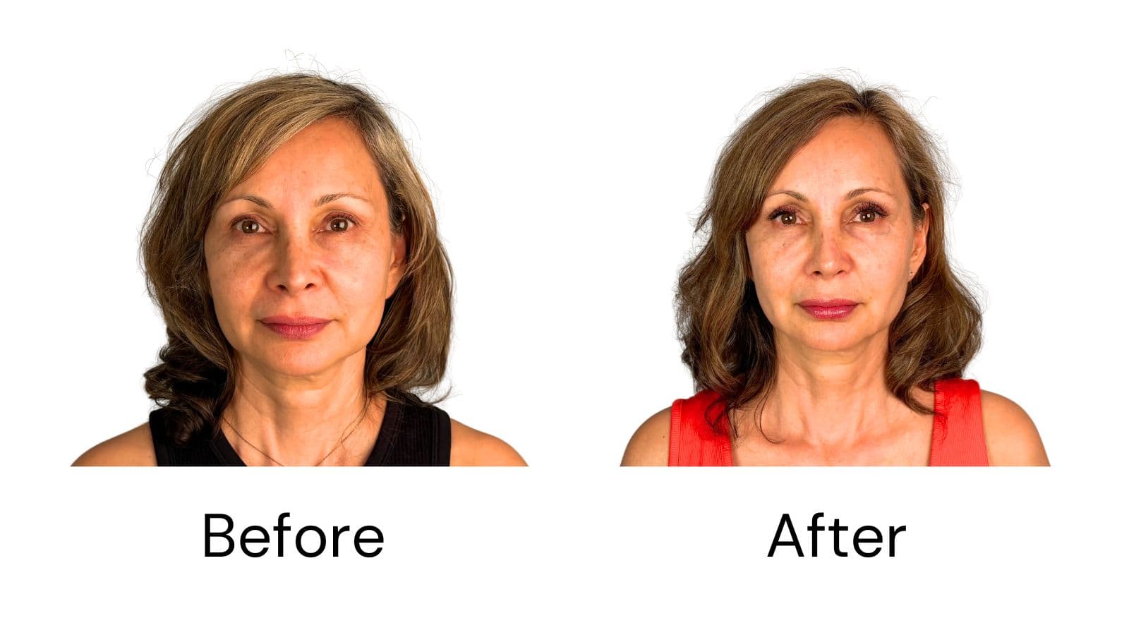 Client Results