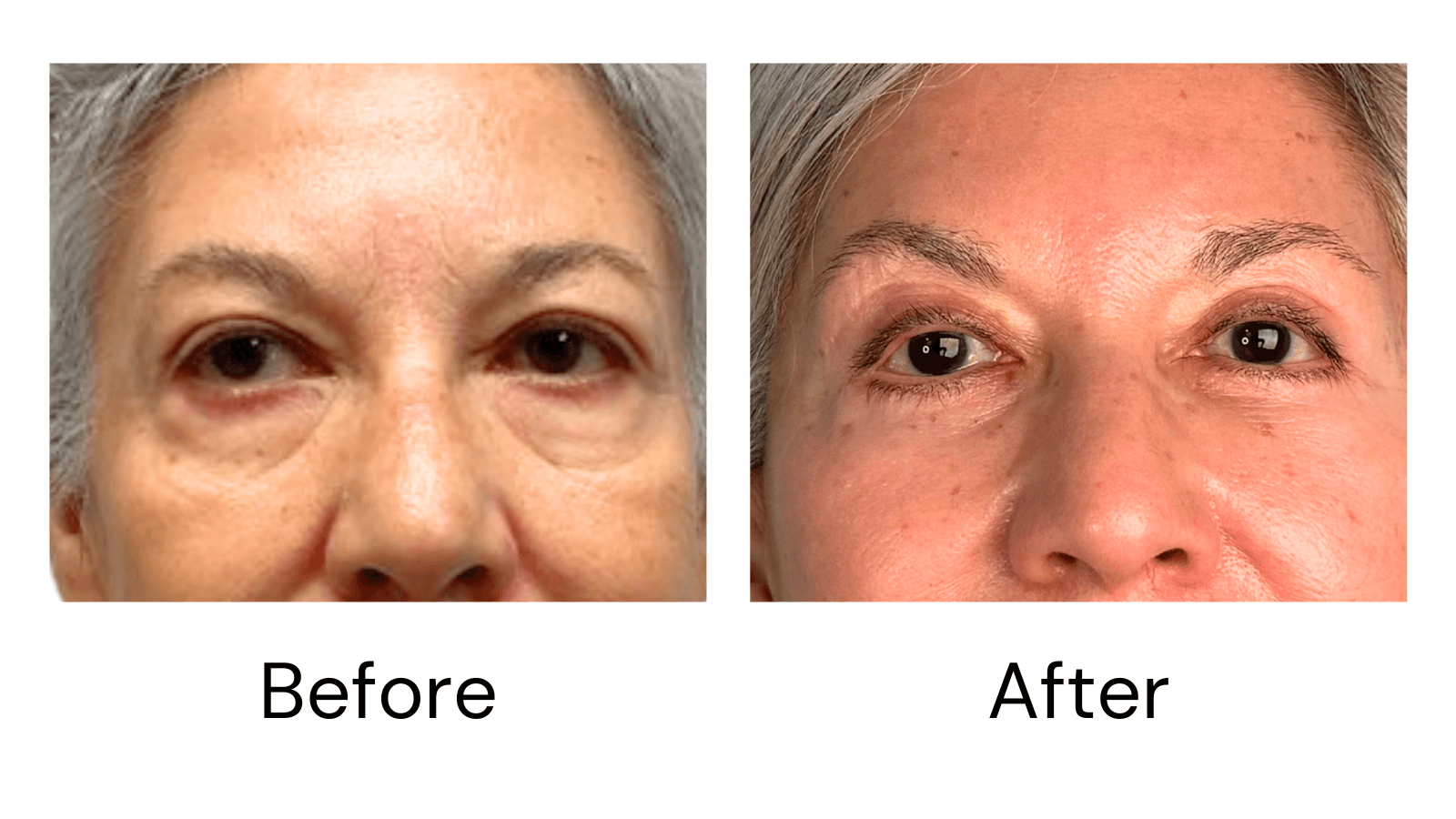 Client result