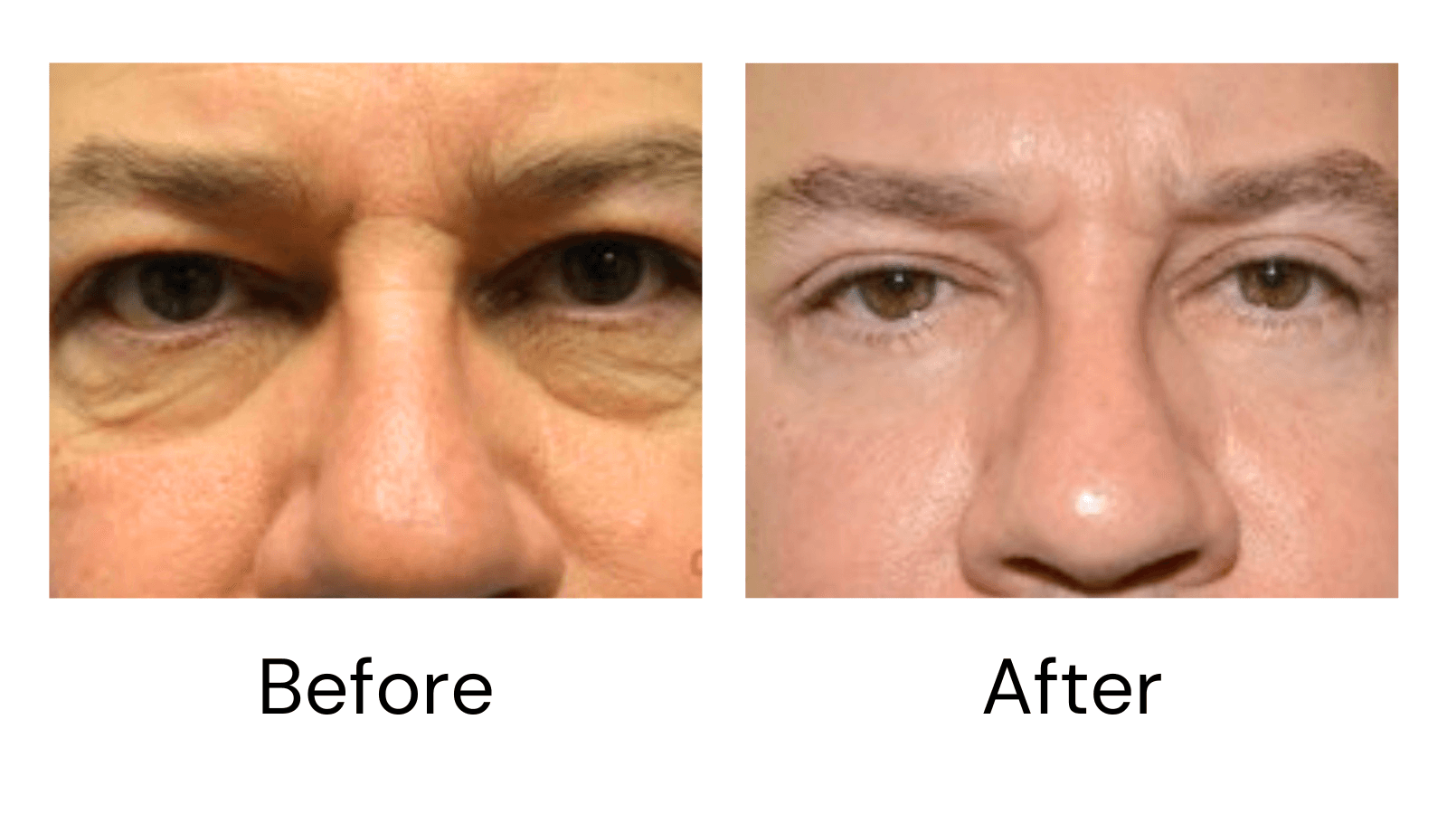 Client result