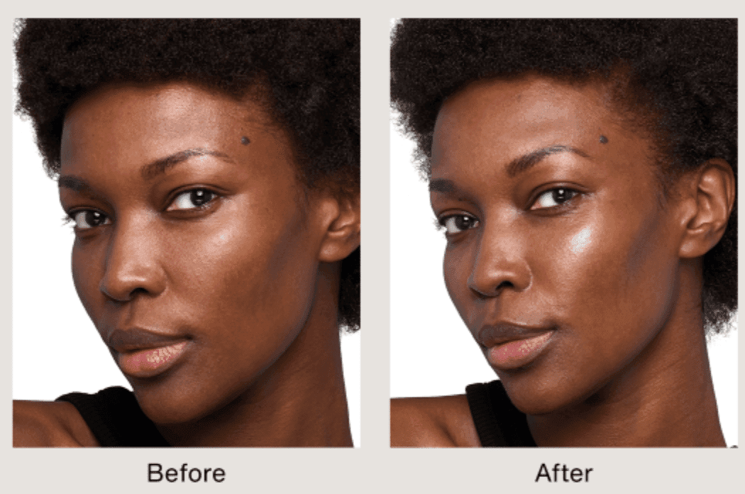 What is Skinvive?