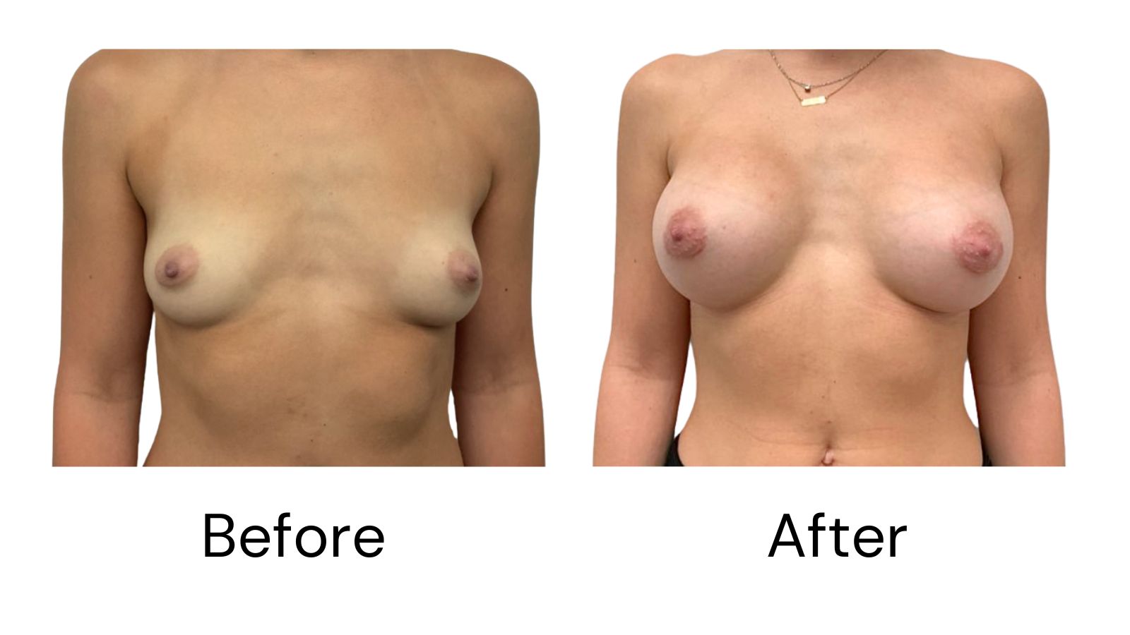 Client results