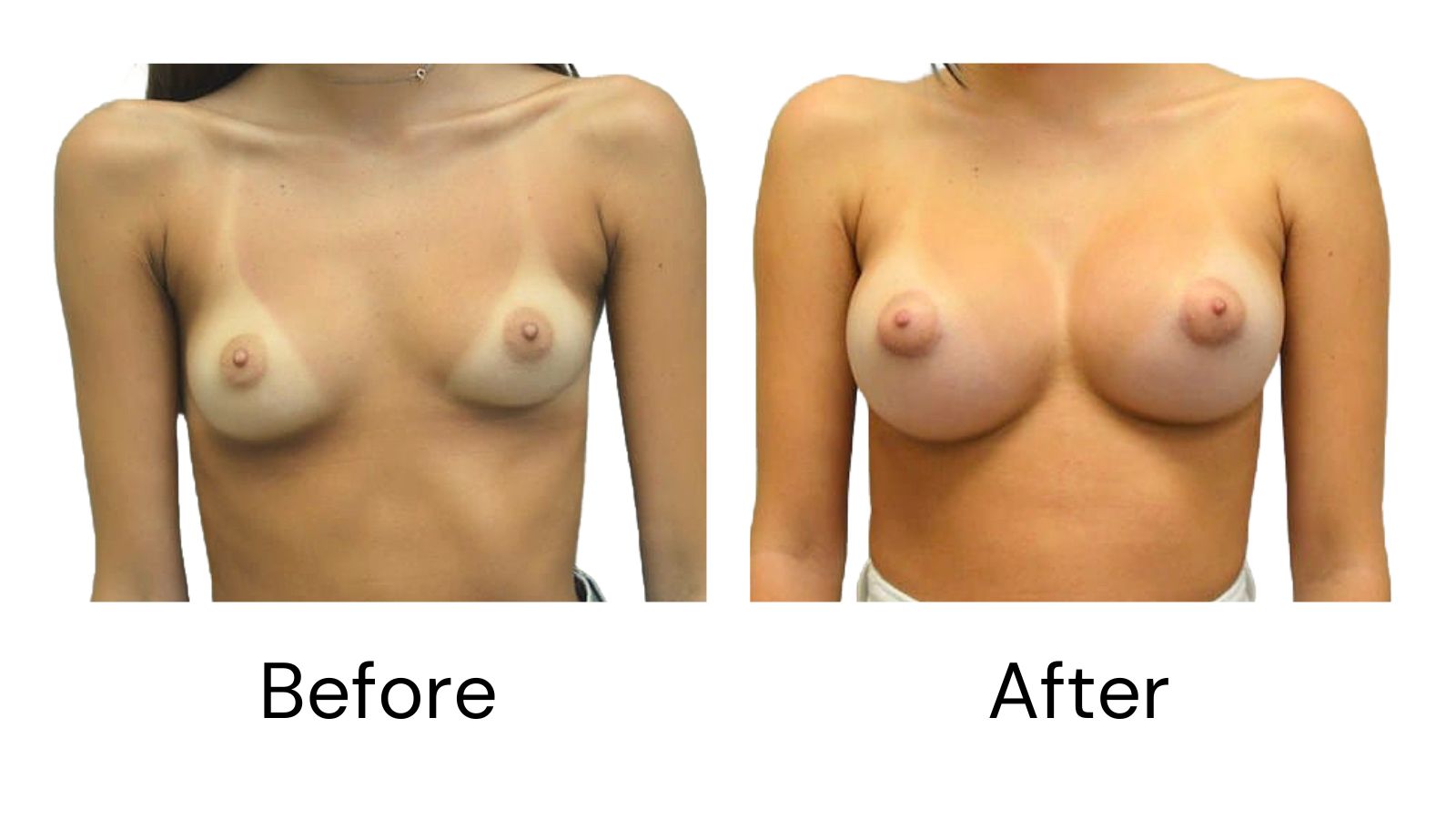 Client results