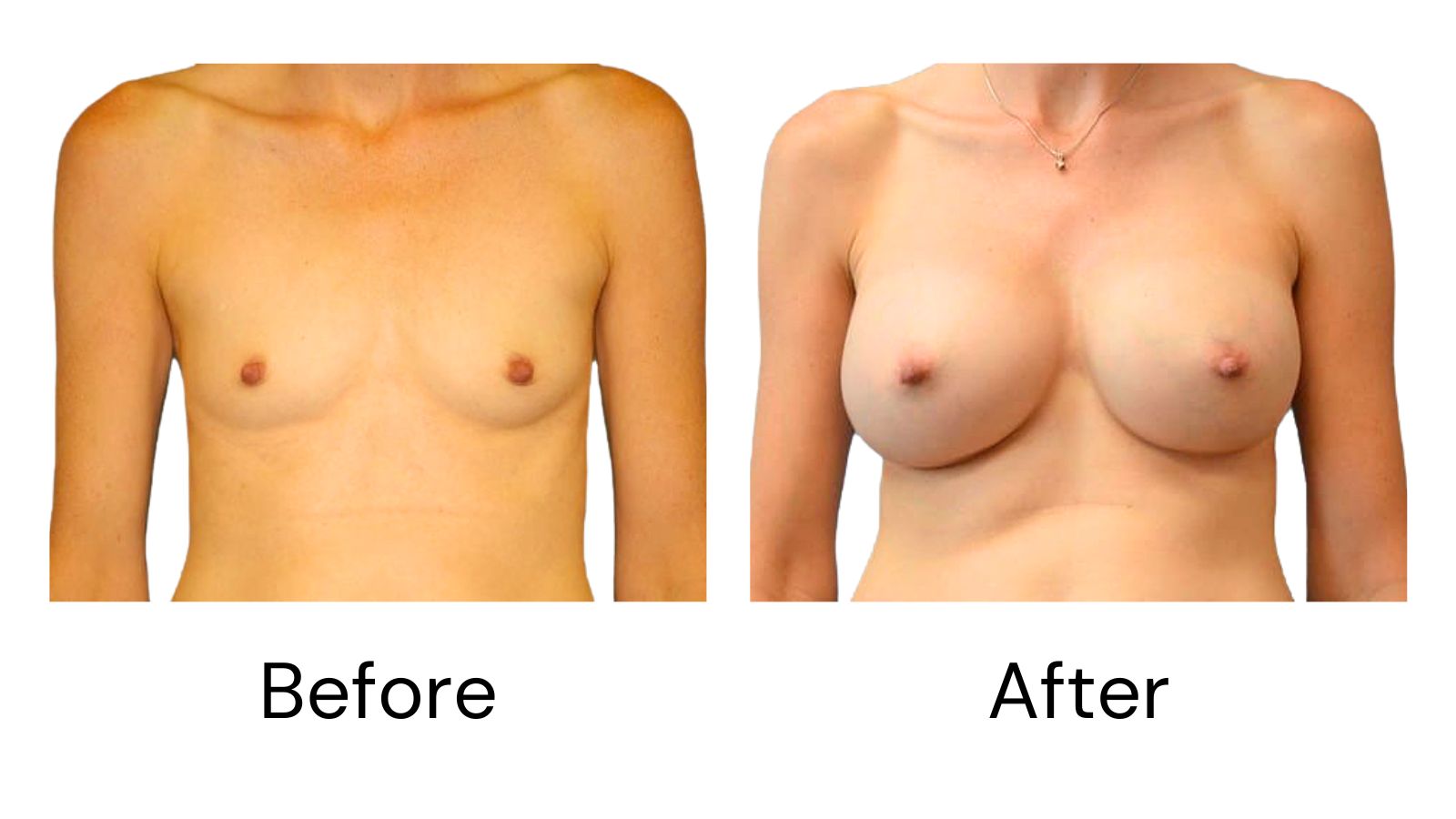 Client results
