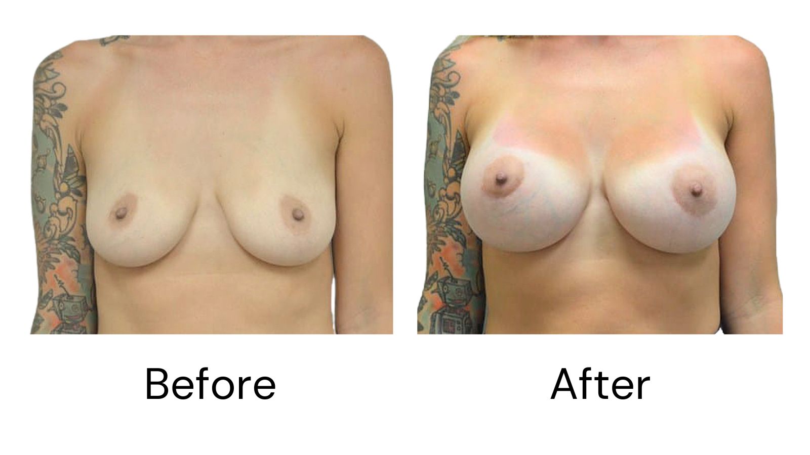 Client results