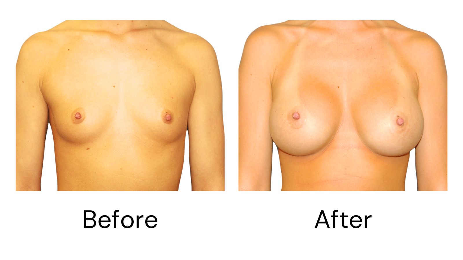 Client results