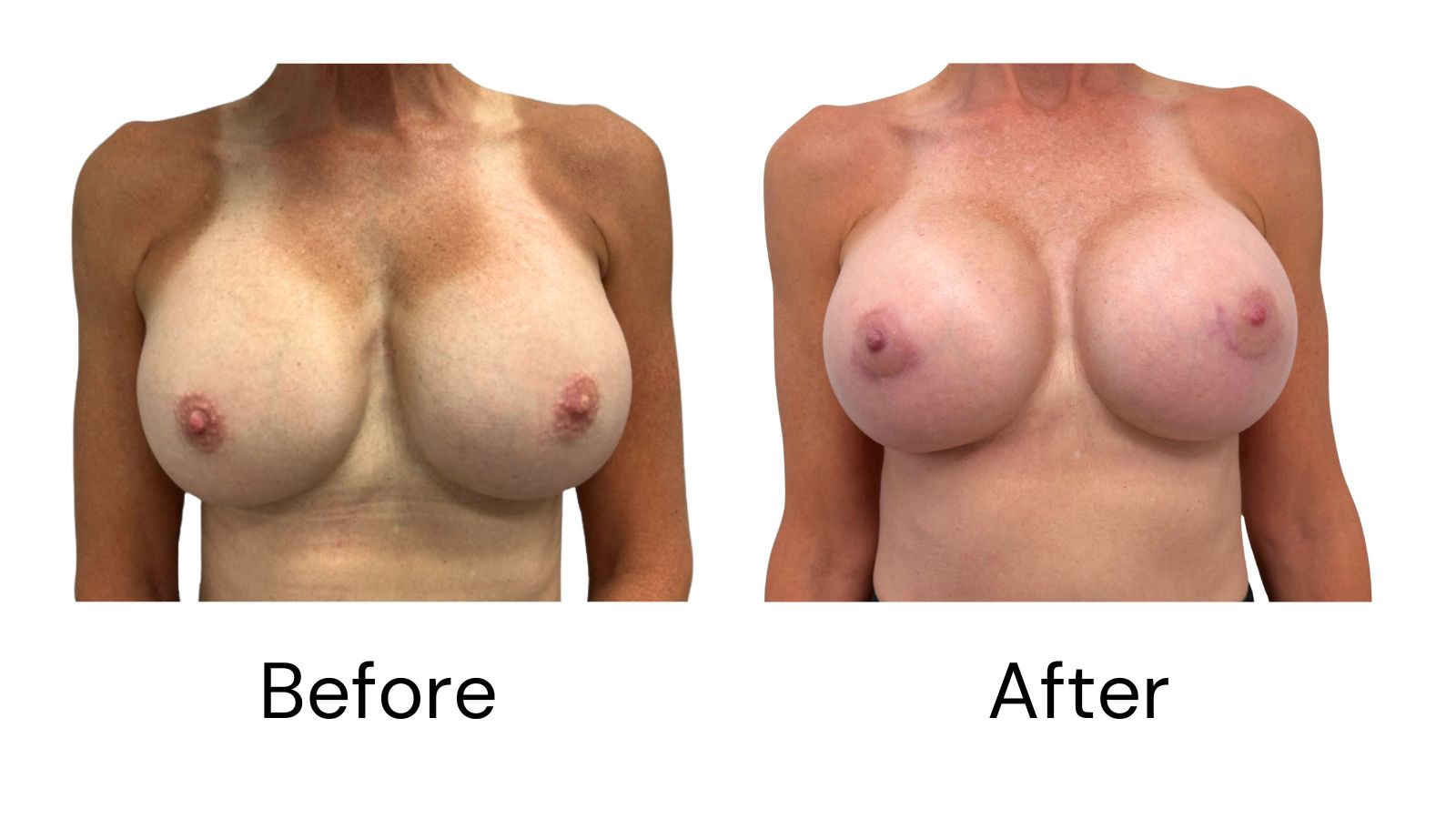 Client results