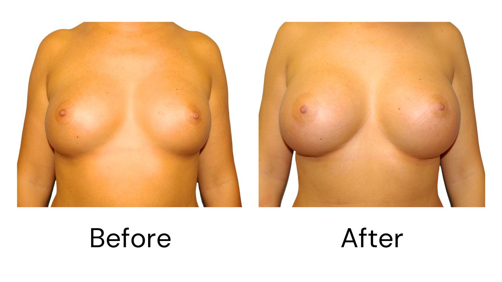Client results