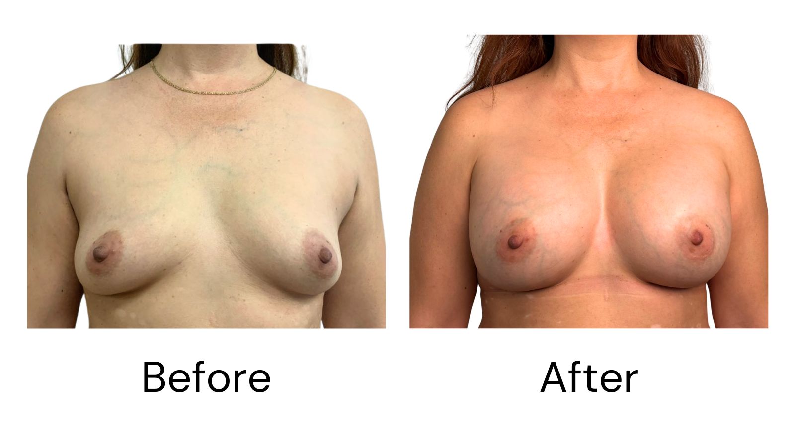 Client results