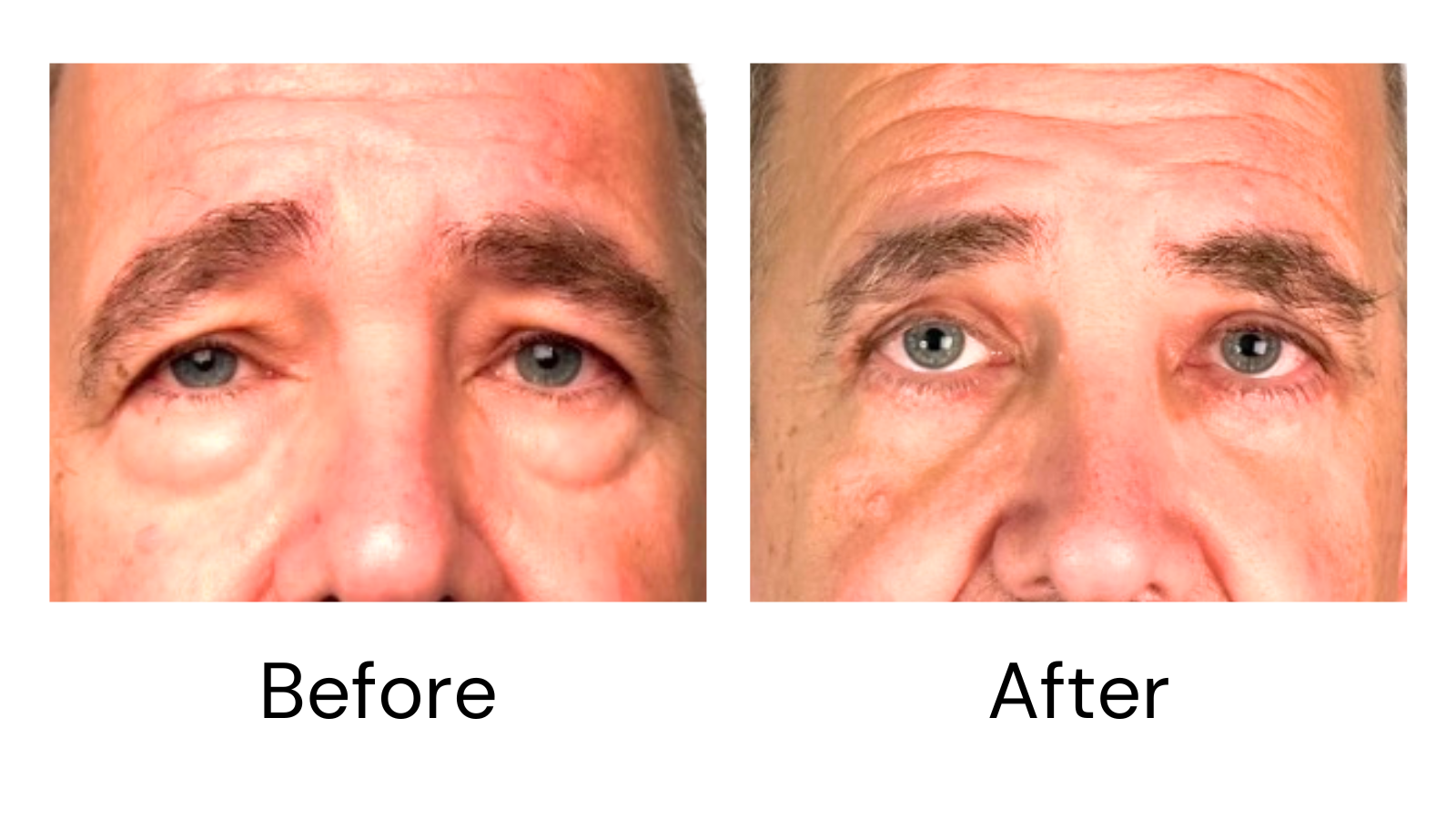 Client result