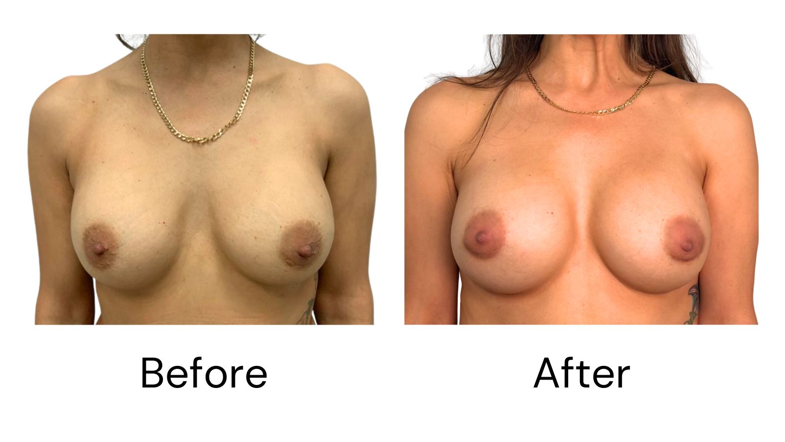 Client results