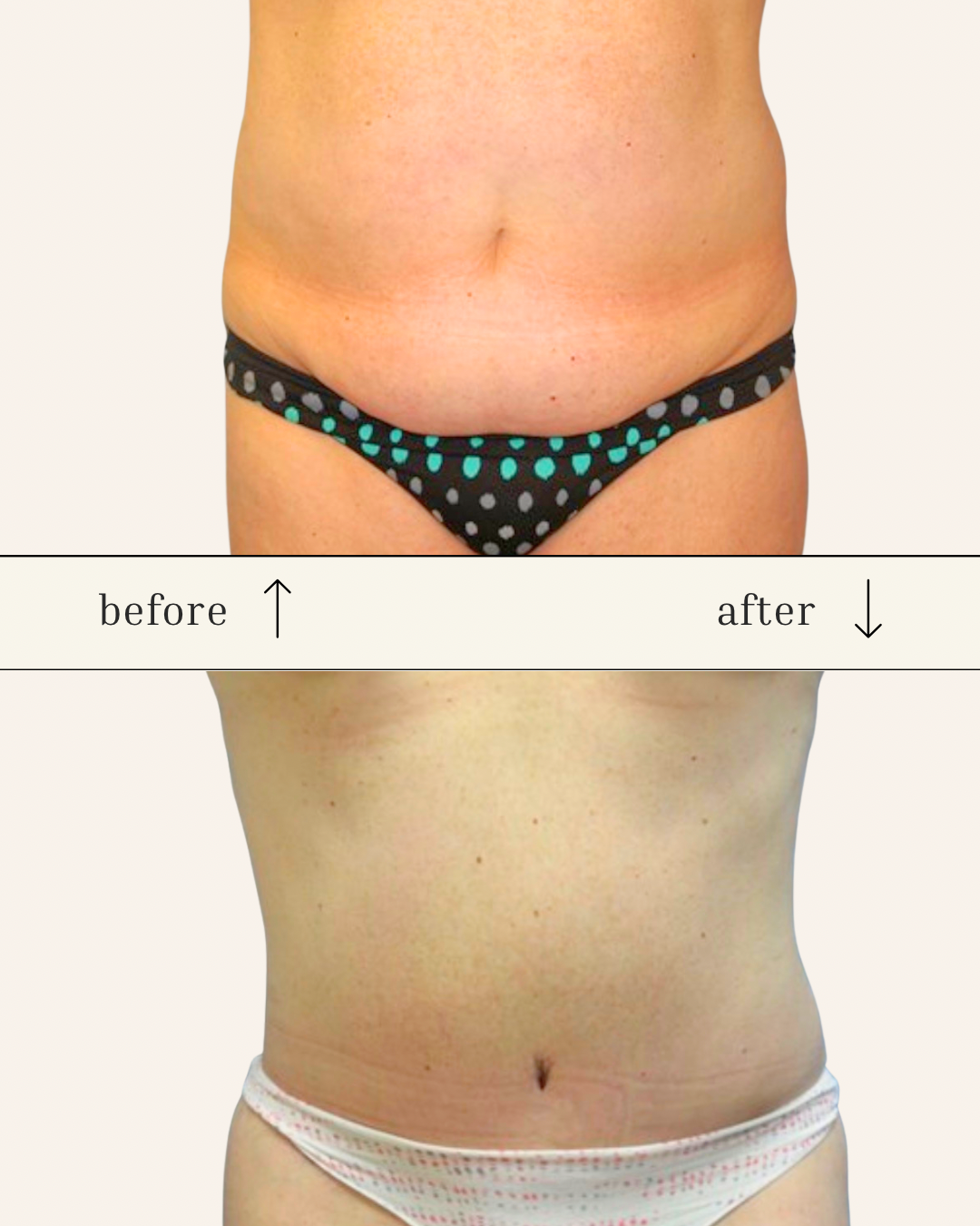 Client results
