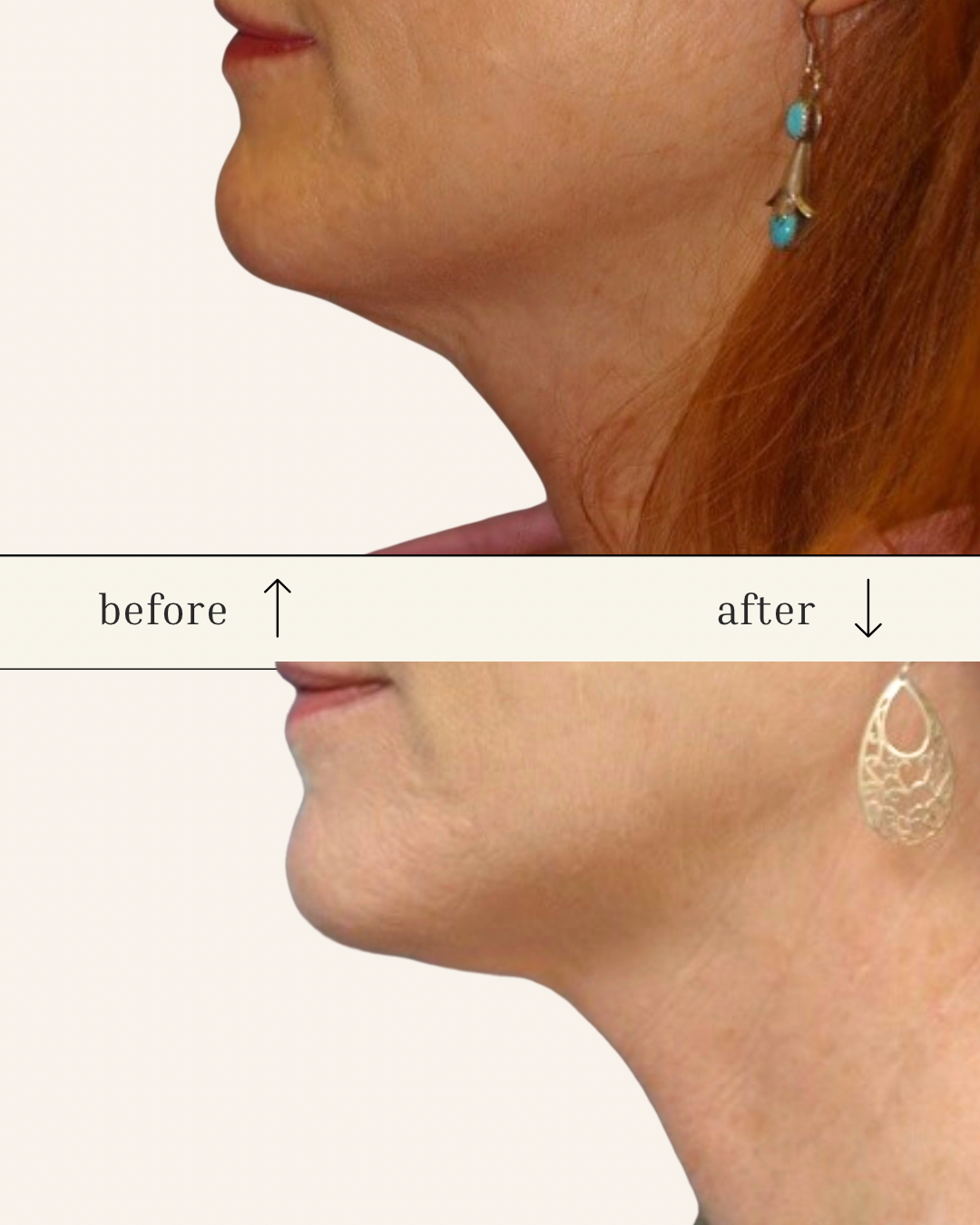 Client results