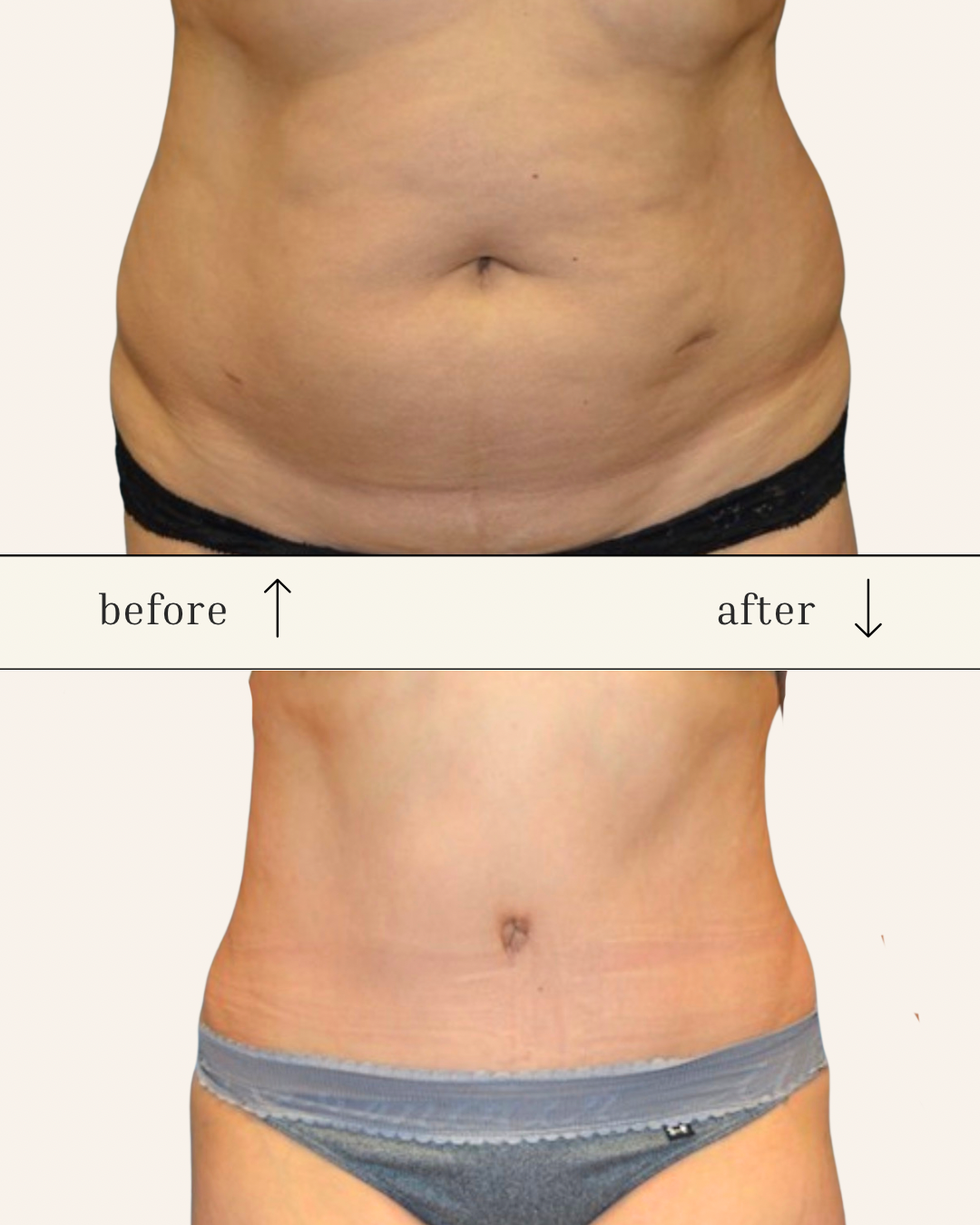 Client results