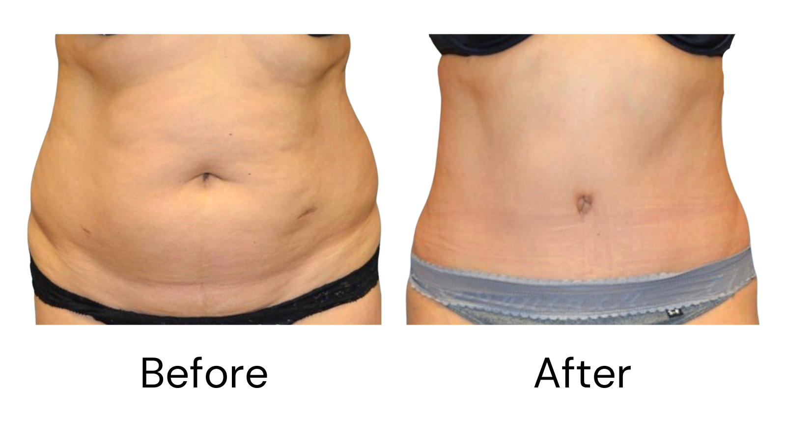 Client results