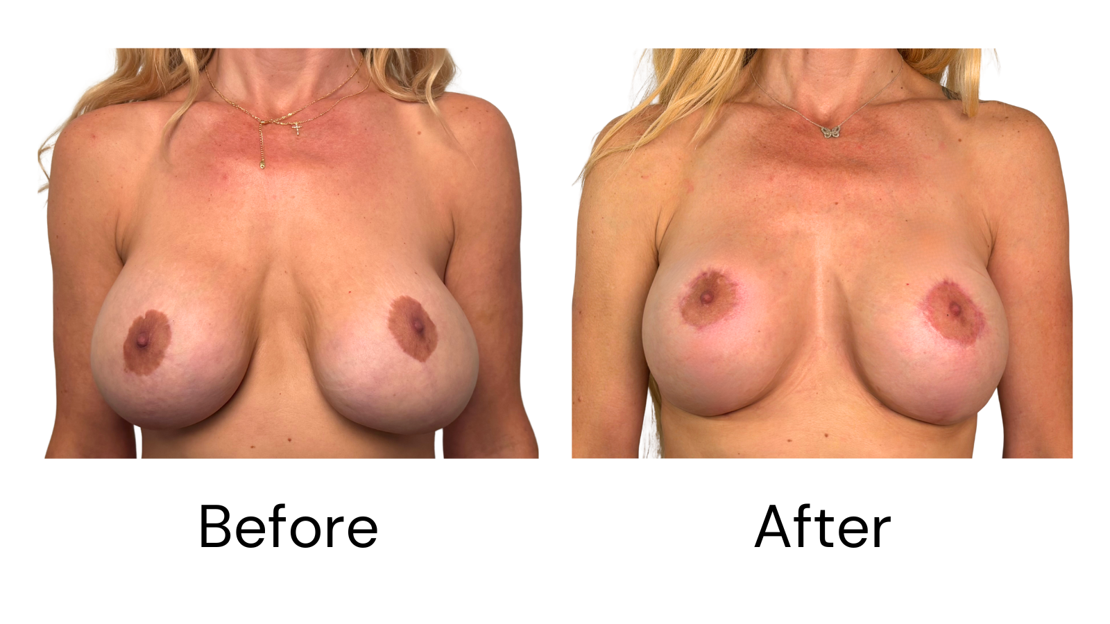 Client results
