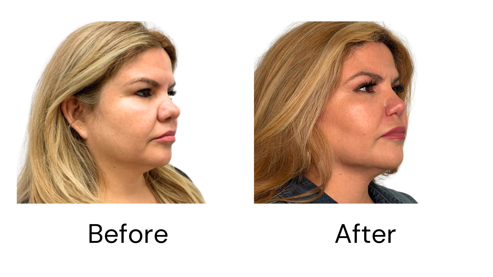 Client Results