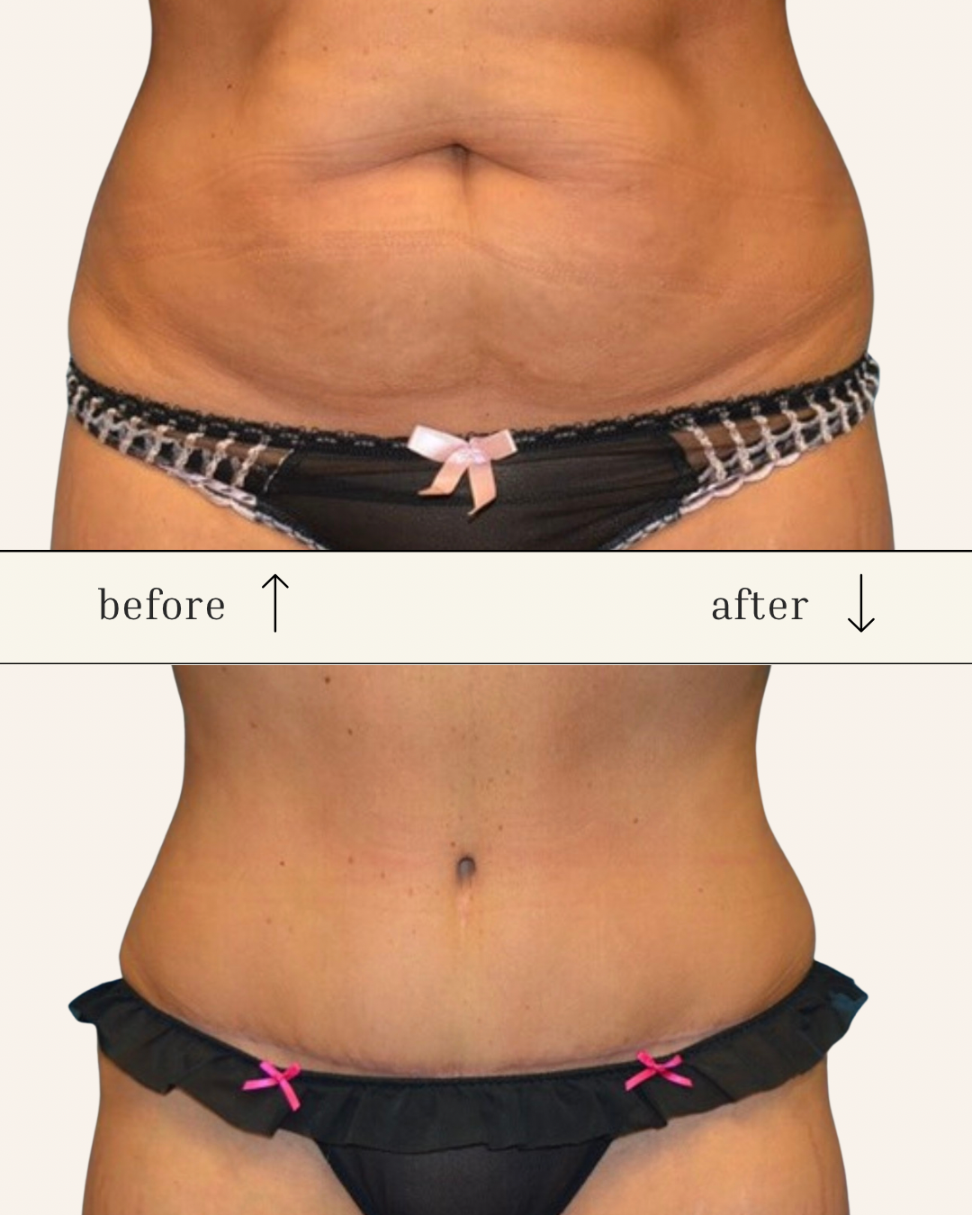 Client results