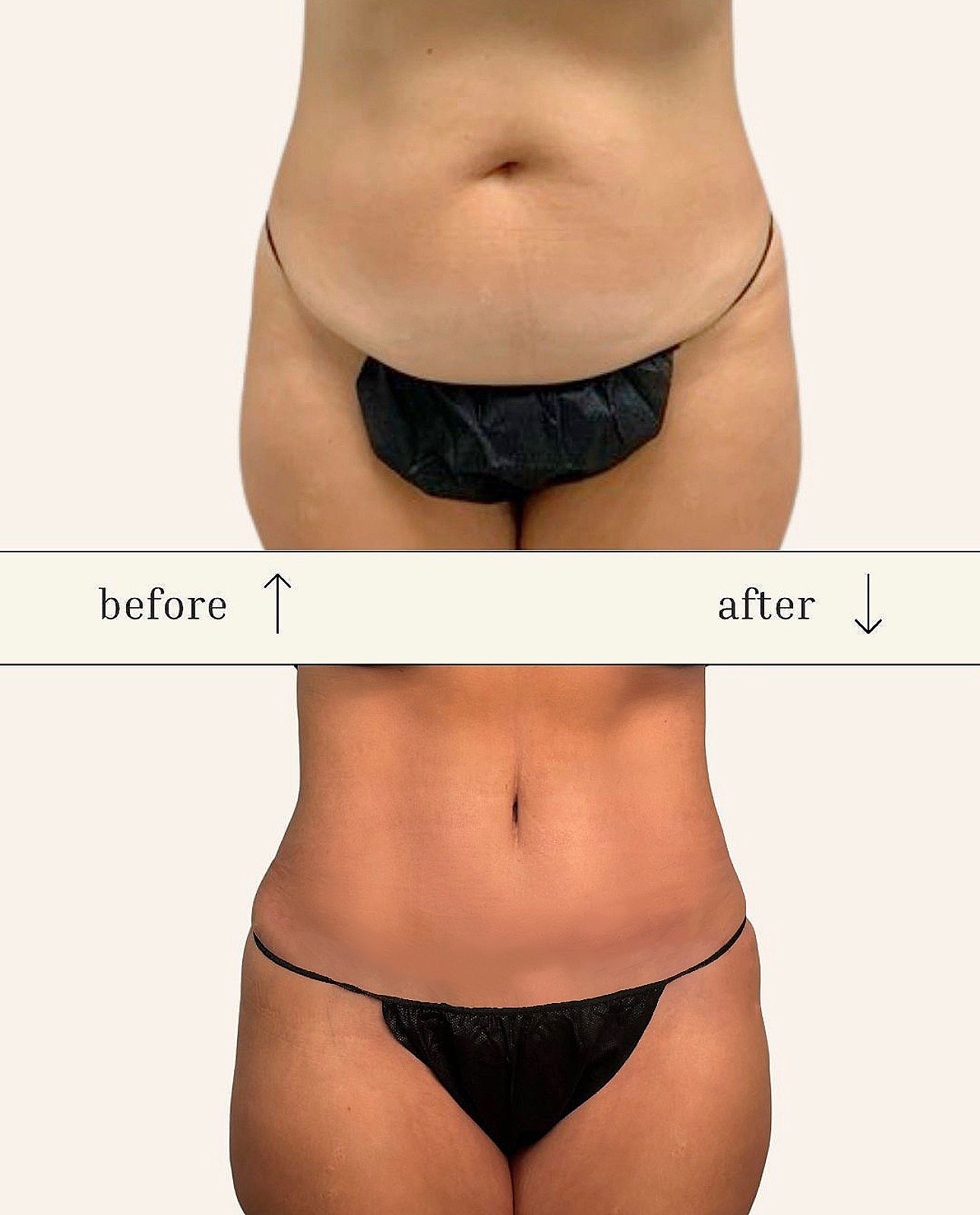 Client results