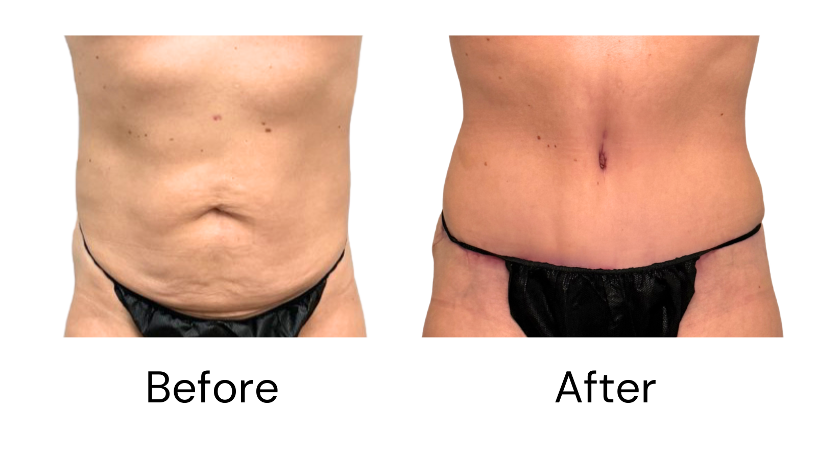 Client results