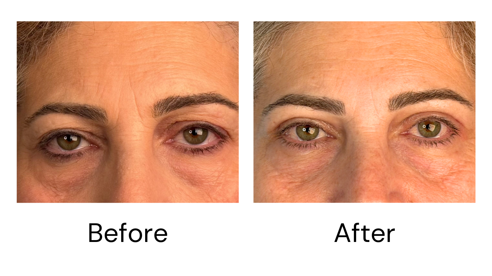 Client result