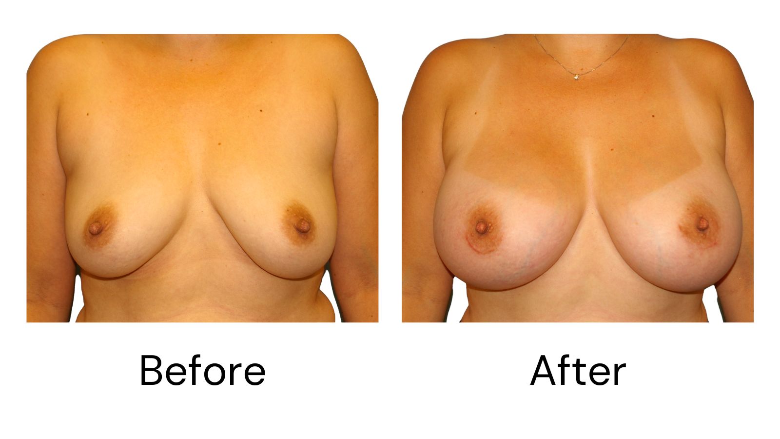 Client results