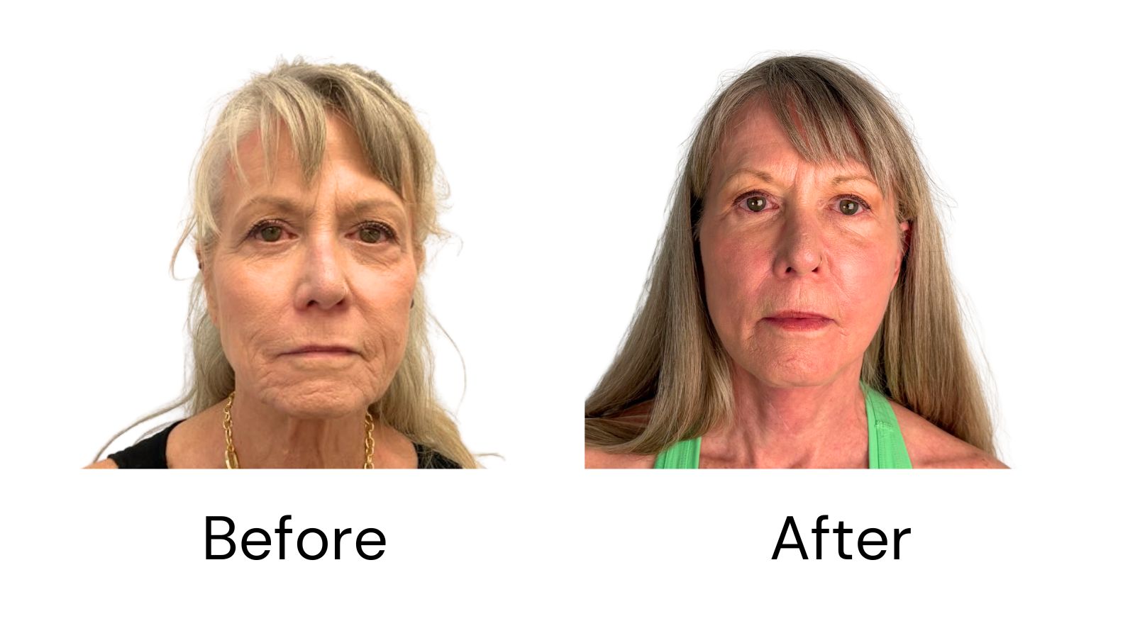 Client results