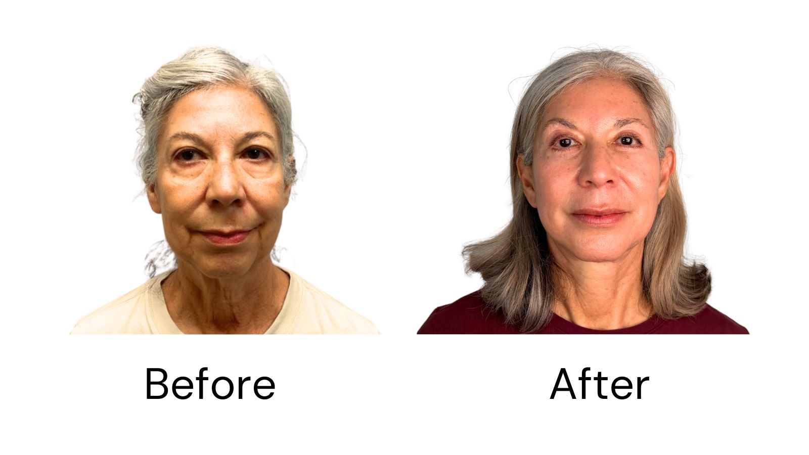 Client results