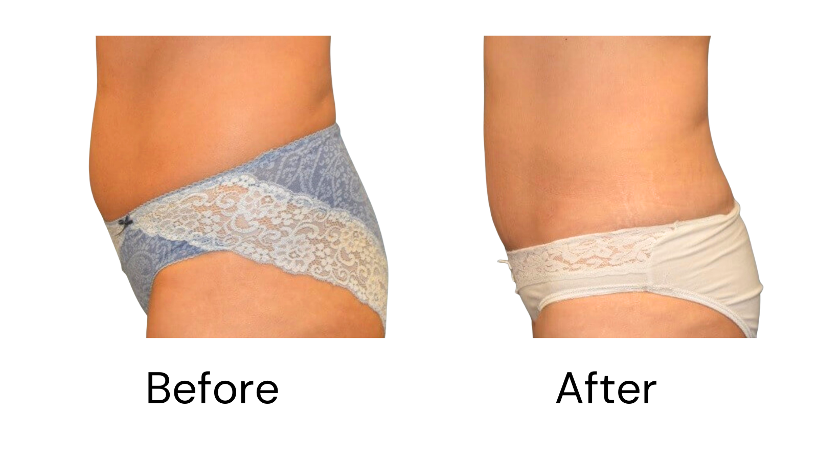 Client results