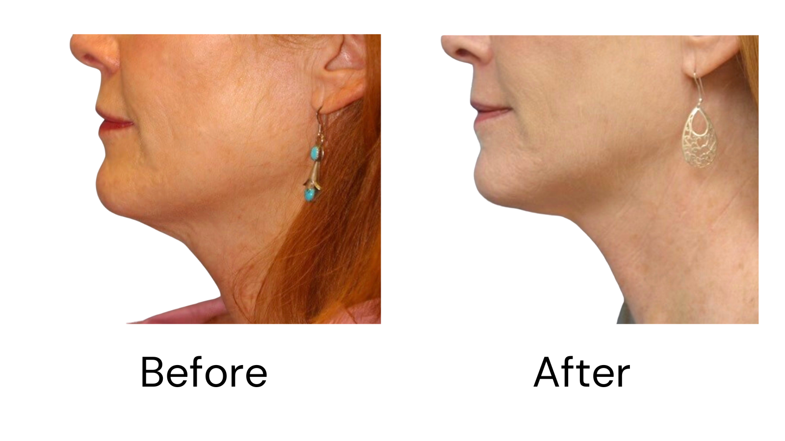 Client results