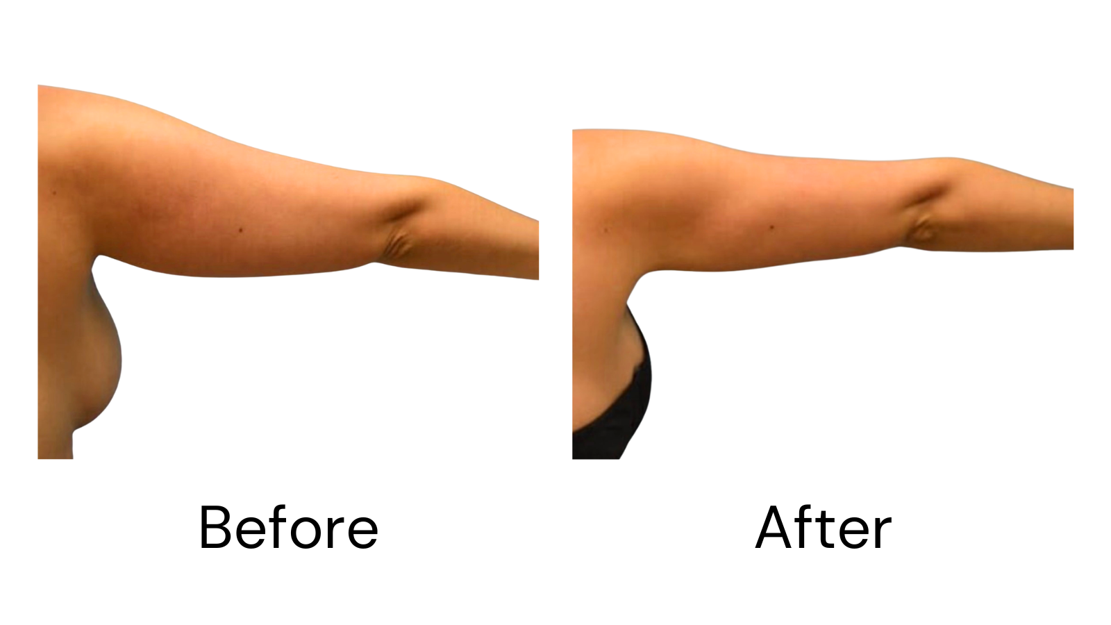 Client results