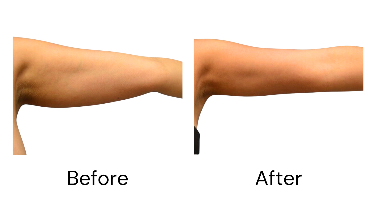 Client results