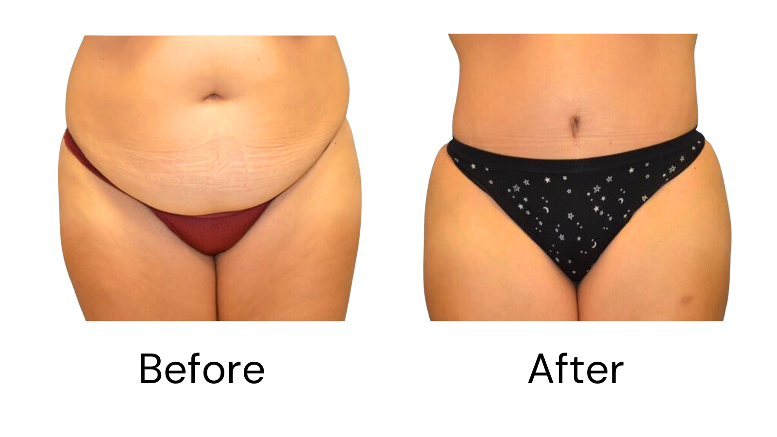 Client results
