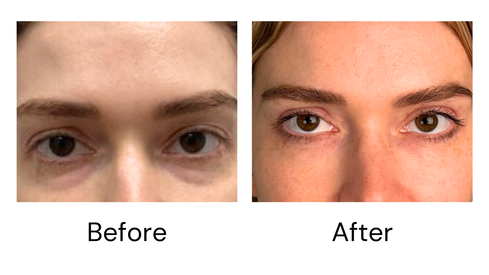 Client result
